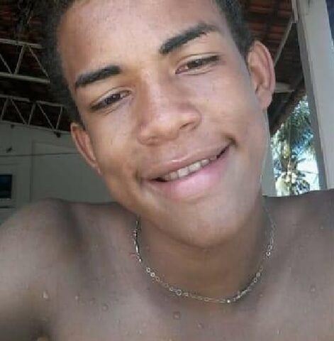 Jean Alexandre, de 17 anos, foi queimado por namorado após briga em MT — Foto: Arquivo pessoal